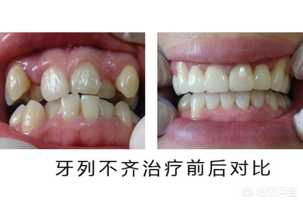 乌鲁木齐最新24小时牙医在线咨询方法分析(最方便真实的乌鲁木齐有没有24小时牙医方法)